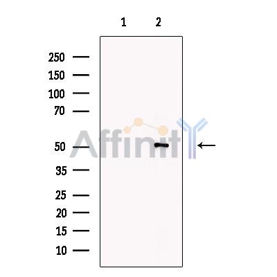 TGN46 Antibody - Western blot analysis of extracts from A549, using TGN46 Antibody.