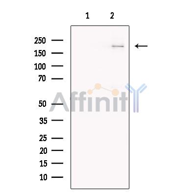 Clathrin heavy chain Antibody - Western blot analysis of extracts from NIH3T3, using Clathrin heavy chain Antibody.