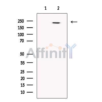 MDC1 Antibody - Western blot analysis of extracts from HEK293, using MDC1 Antibody.