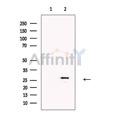 cbx7 Antibody - Western blot analysis of extracts from Hela cells, using cbx7  Antibody.