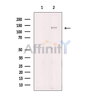 Mannosidase II Antibody - Western blot analysis of extracts from COS7, using Mannosidase II Antibody.