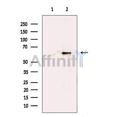 Lgi1 Antibody - Western blot analysis of extracts from Mouse  brain, using Lgi1 Antibody.