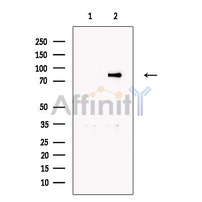 MTA2 Antibody - Western blot analysis of extracts from Hela cells, using MTA2 Antibody.
