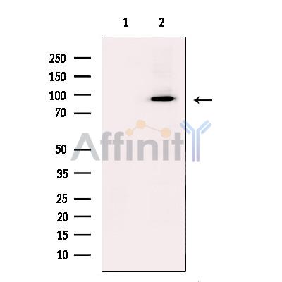 CD62P Antibody - Western blot analysis of extracts from Jurkat, using CD62P Antibody.