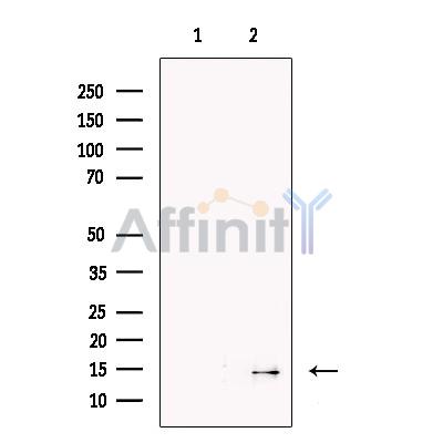 SAA2 Antibody - Western blot analysis of extracts from Human  liver, using SAA Antibody.