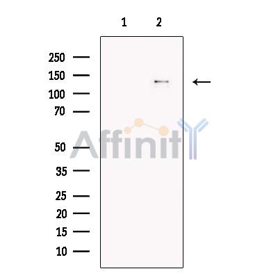 CHL1 Antibody - Western blot analysis of extracts from HL60, using CHL1 Antibody.