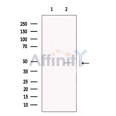 hair cortex Cytokeratin Antibody - Western blot analysis of extracts from LOVO, using hair cortex Cytokeratin Antibody.