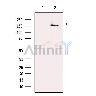 Lubricin Antibody - Western blot analysis of extracts from Human  liver , using Lubricin Antibody.