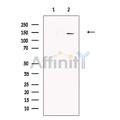 STIL Antibody - Western blot analysis of extracts from Hela cells, using STIL Antibody.
