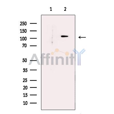 PHF8 Antibody - Western blot analysis of extracts from Hela cells, using PHF8 Antibody.