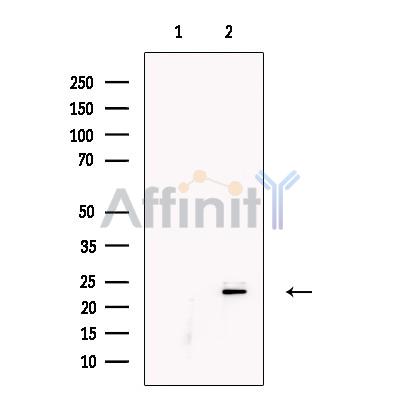 KGF Antibody - Western blot analysis of extracts from A431 cells, using KGF Antibody.
