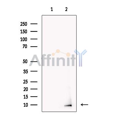 Neuronatin Antibody - Western blot analysis of extracts from Mouse  brain, using Neuronatin Antibody.