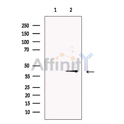 DNase II Antibody - Western blot analysis of extracts from Human  spleen, using DNase II Antibody.