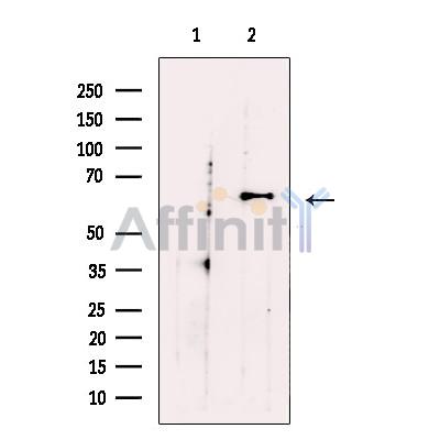 Glypican 2 Antibody - Western blot analysis of extracts from T47D, using Glypican 2 Antibody.