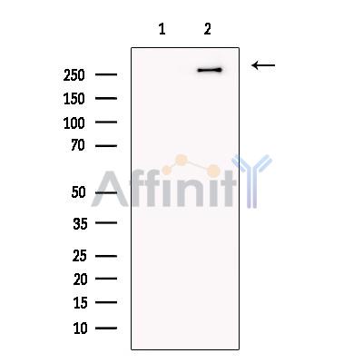 Trichohyalin Antibody - Western blot analysis of extracts from Human  kidney, using Trichohyalin Antibody.