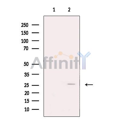 FKBP25 Antibody - Western blot analysis of extracts from Hela cells, using FKBP25 Antibody.