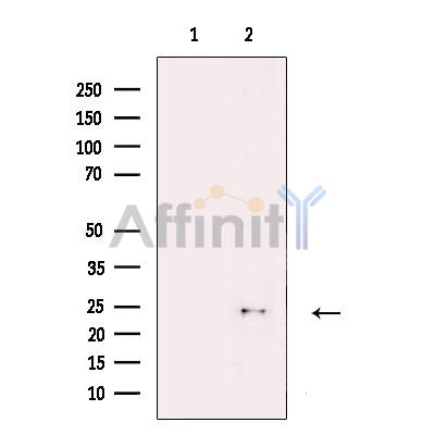 Loricrin Antibody - Western blot analysis of extracts from T47D, using Loricrin Antibody.