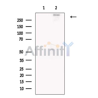 Chd7 Antibody - Western blot analysis of extracts from SK-N-SH, using Chd7 Antibody.