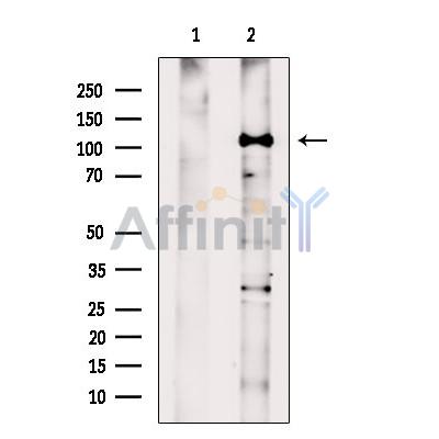 HLTF Antibody - Western blot analysis of extracts from Rat  lung, using HLTF Antibody.