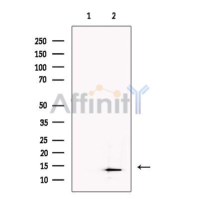 SLIRP Antibody - Western blot analysis of extracts from Human  liver, using SLIRP Antibody.