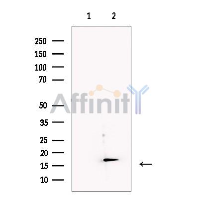 IEX1 Antibody - Western blot analysis of extracts from Human  Adrenal, using IEX1 Antibody.