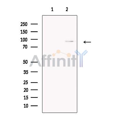 CPEB4 Antibody - Western blot analysis of extracts from Human  Fetal lung, using CPEB4 Antibody.