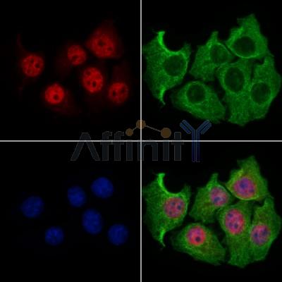 SLFN11 Antibody - DF13515 staining HepG2 cells by IF/ICC.
