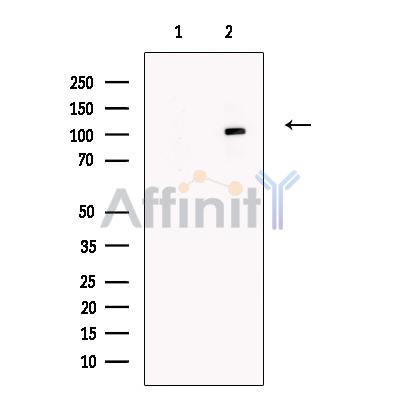SLFN11 Antibody - Western blot analysis of extracts from Human  pancreas, using SLFN11 Antibody.