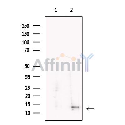 oncomodulin Antibody - Western blot analysis of extracts from Human  pancreas, using oncomodulin Antibody.