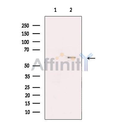 Kv1.6 Antibody - Western blot analysis of extracts from Hek293 , using Kv1.