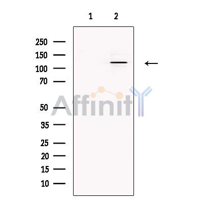 SMARCA1 Antibody - Western blot analysis of extracts from Hek293, using SMARCA1 Antibody.