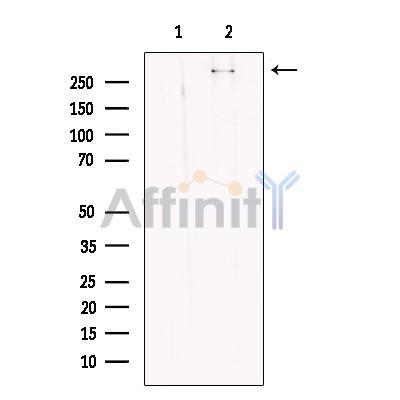 KMT2A / MLL Antibody - Western blot analysis of extracts from K562, using KMT2A / MLL Antibody.