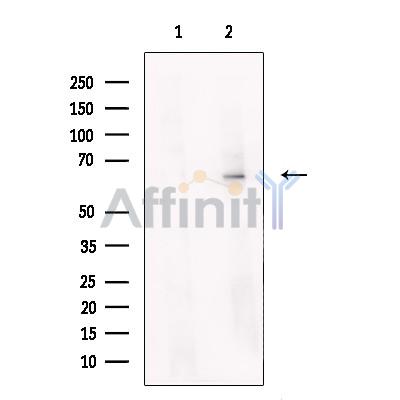 Steroid sulfatase Antibody - Western blot analysis of extracts from Human  Placental, using Steroid sulfatase Antibody.