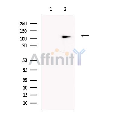 SLFN14 Antibody - Western blot analysis of extracts from Human  kidney, using SLFN14 Antibody.