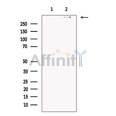 DNAH5 Antibody - Western blot analysis of extracts from Human  fallopian tube, using DNAH5 Antibody.