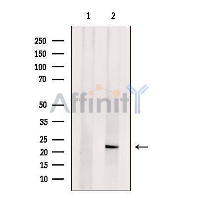 C9orf142 Antibody - Western blot analysis of extracts from Hela cells, using C9orf142 Antibody.