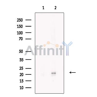 C9orf142 Antibody - Western blot analysis of extracts from RT4, using C9orf142 Antibody.