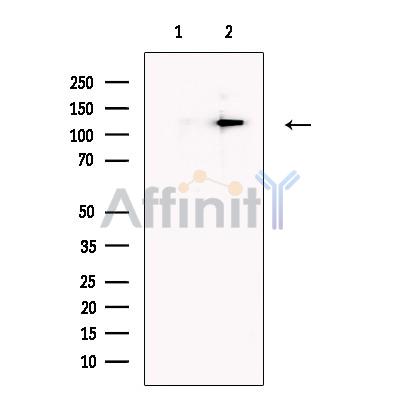 PTCH2 Antibody - Western blot analysis of extracts from Hela cells, using PTCH2 Antibody.