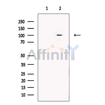Sulfatase 1 Antibody - Western blot analysis of extracts from Human  skeletal muscle, using Sulfatase 1 Antibody.