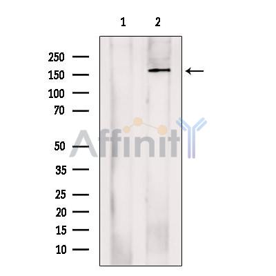 ADCY10 Antibody - Western blot analysis of extracts from Hela cells, using ADCY10 Antibody.