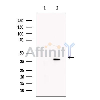 KLF2 Antibody - Western blot analysis of extracts from Human  colon carcinoma, using KLF2 Antibody.