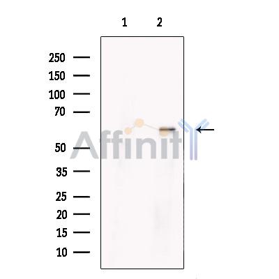 PRMT3 Antibody - Western blot analysis of extracts from HCT116, using PRMT3  Antibody.