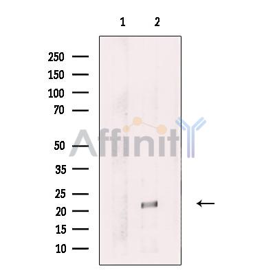 Amino-terminal enhancer of split Antibody - Western blot analysis of extracts from Jurkat, using Amino-terminal enhancer of split Antibody.