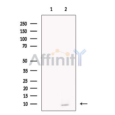 Neurogranin Antibody - Western blot analysis of extracts from Rat  brain , using Neurogranin Antibody.