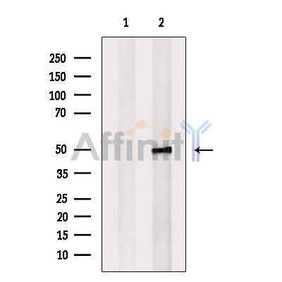Repulsive Guidance Molecule A Antibody - Western blot analysis of extracts from HepG2 cells, using Repulsive Guidance Molecule A Antibody.