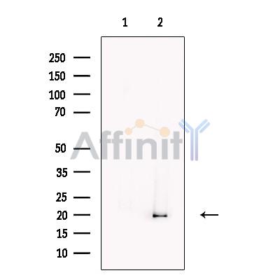 AIMP3/p18 Antibody - Western blot analysis of extracts from HEK293, using AIMP3/p18 Antibody.