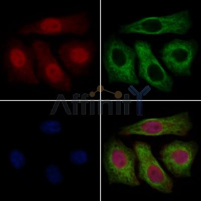 E1 Ubiquitin Activating Enzyme Antibody - DF13630 staining Hela cells by IF/ICC.