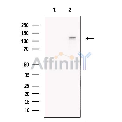 E1 Ubiquitin Activating Enzyme Antibody - Western blot analysis of extracts from A431 cells, using E1 Ubiquitin Activating Enzyme Antibody.