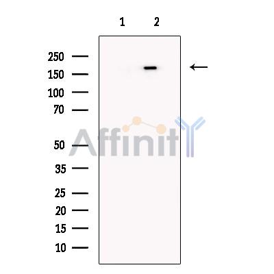KDM5C / Jarid1C / SMCX Antibody - Western blot analysis of extracts from MCF-7, using KDM5C / Jarid1C / SMCX Antibody.