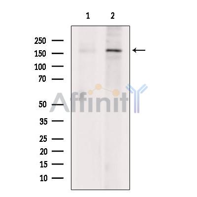 KDM5C / Jarid1C / SMCX Antibody - Western blot analysis of extracts from DU145 cells, using KDM5C / Jarid1C / SMCX Antibody.